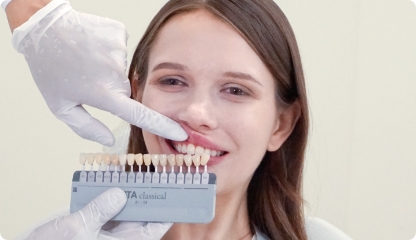 2. Select three shade guides that are close to patient’s tooth color